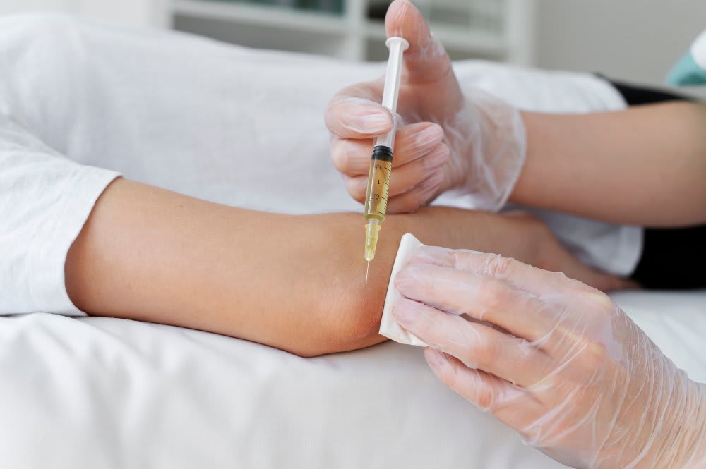 PRP Injections for Joint Pain