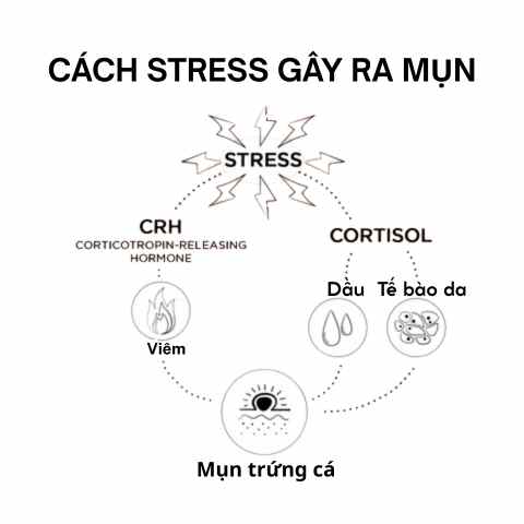 Stress và da dầu mụn