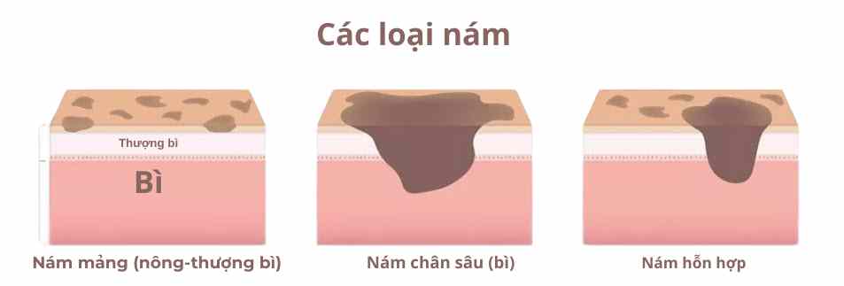 Phân loại nám