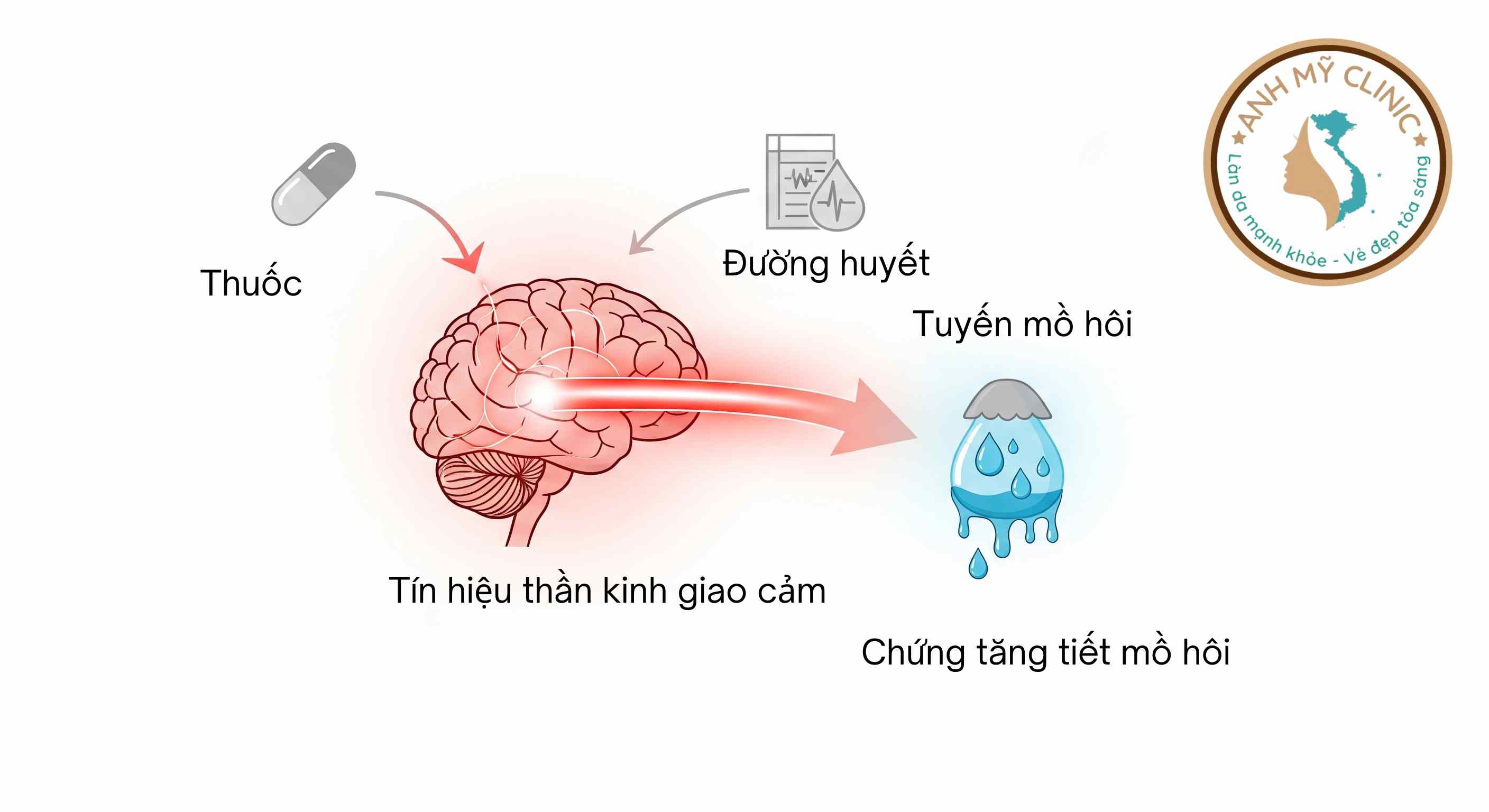 Nguyên nhân tăng tiết mồ hôi