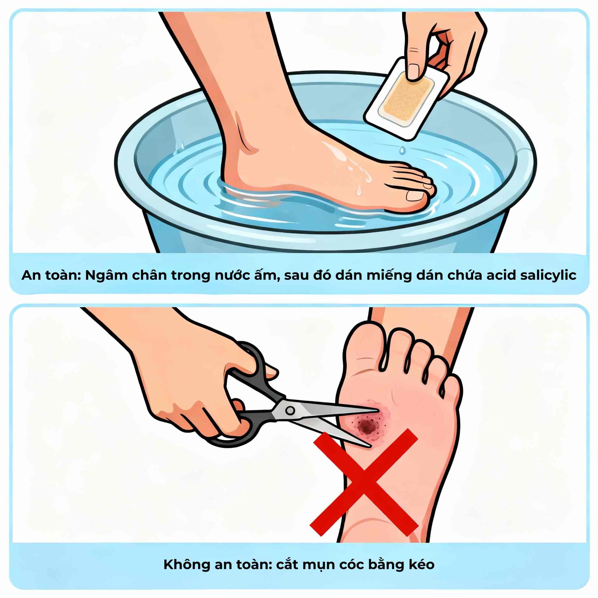 Minh họa so sánh điều trị mụn cóc tại nhà an toàn bằng acid salicylic và nguy hiểm khi tự cắt nặn