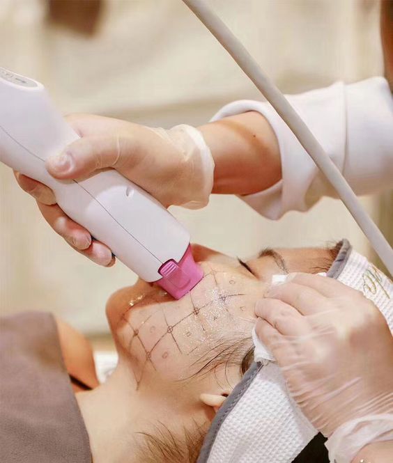 Điều trị trẻ hóa da bằng sóng RF vi kim giúp săn chắc và giảm nếp nhăn tại Anh Mỹ Clinic