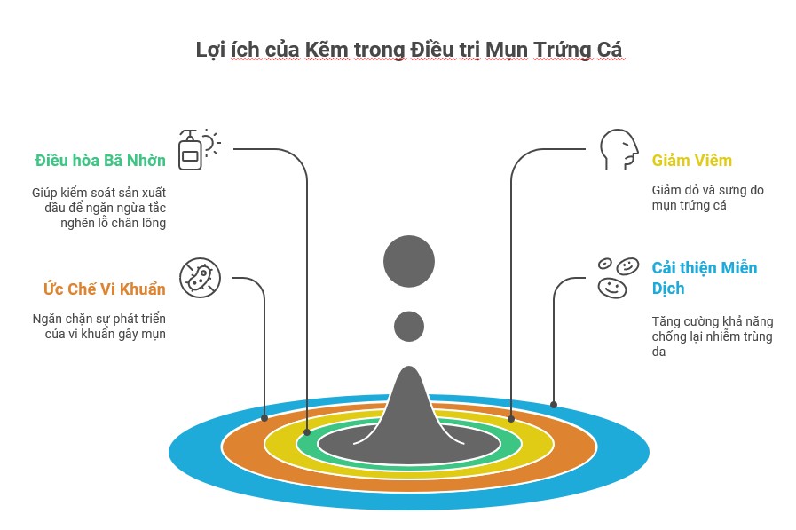 Hình ảnh minh họa lợi ích của kẽm trong điều trị mụn trứng cá, bao gồm việc điều hòa bã nhờn, ức chế vi khuẩn, giảm viêm và cải thiện miễn dịch, giúp điều trị mụn hiệu quả.