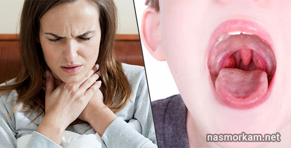 Чем лечить воспаление в горле