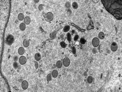 Virus_EM