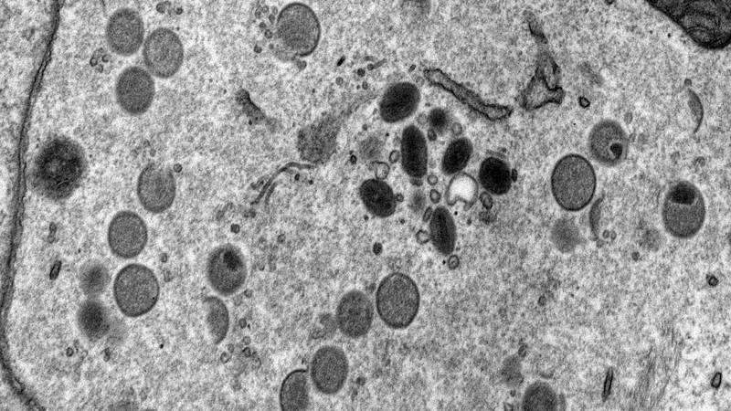 Virus_EM