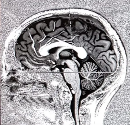 april brain scan