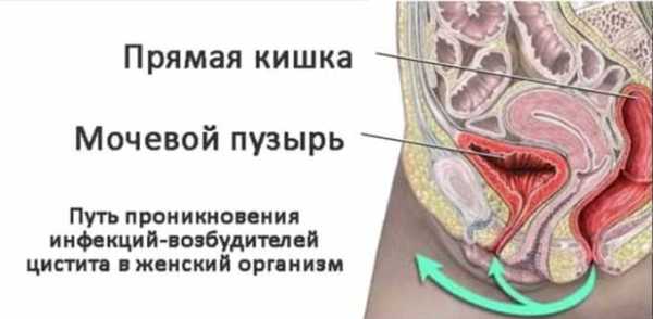 Расположение мочевого пузыря в брюшной полости