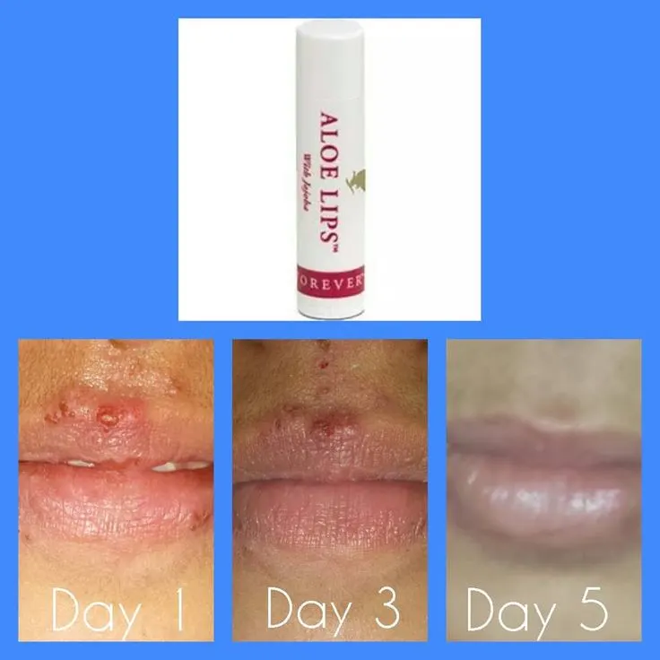 FOREVER ALOE LIPS 3