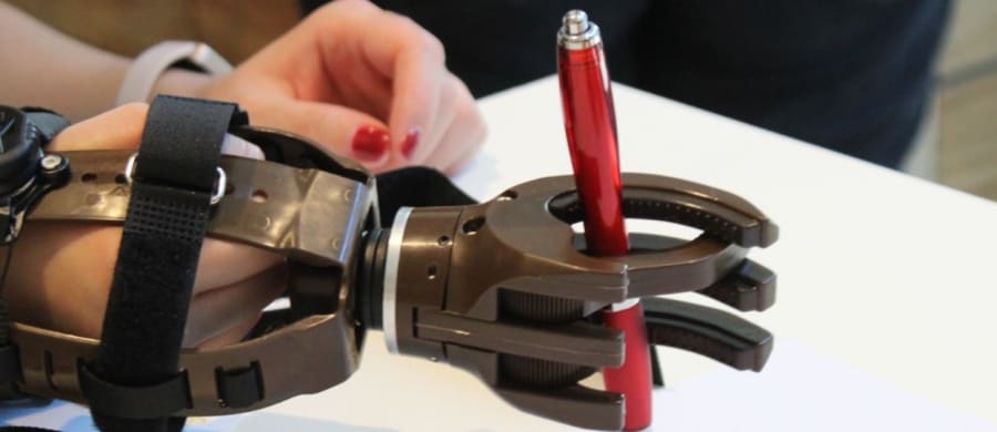 Handprothesen Bau