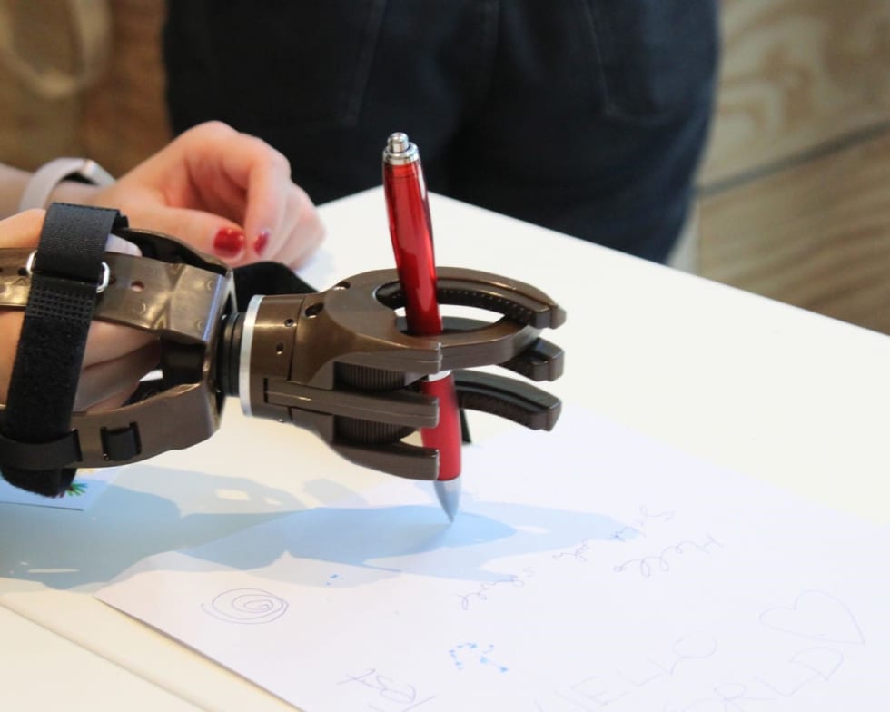 Weihnachts-Werkstatt Handprothesen