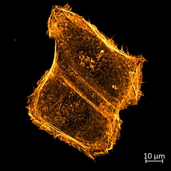 U2Os - Actin | SIM Apotome