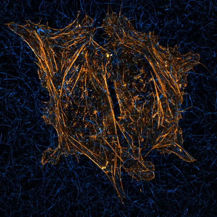 U2Os - Actin + Collagen | Lattice SIM