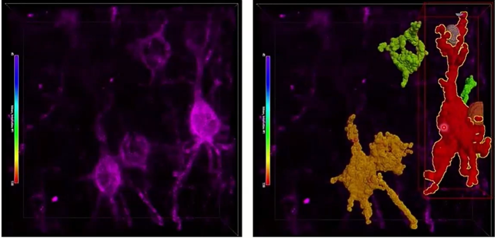 SfN 2025 Booth Talk: Keerthi Krishnan | PNNs