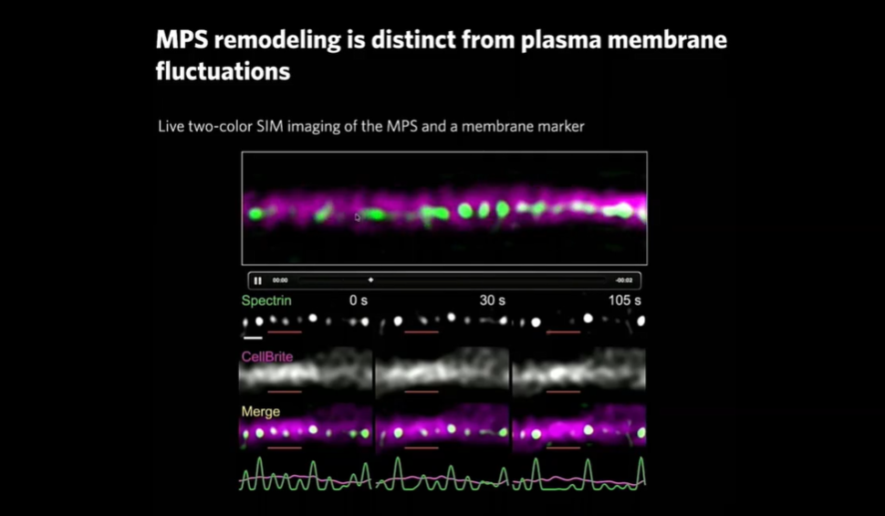 SfN2025 Booth Talk: Evan Heller | Actin Cytoskeleton