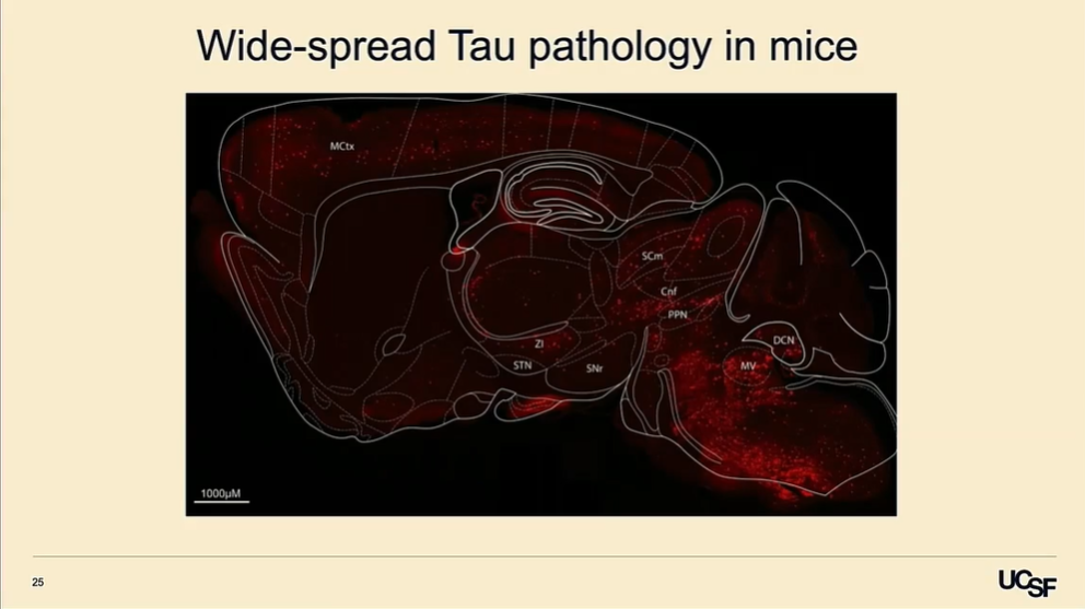 SfN2025 Booth Talk: Rose Creed | PSP