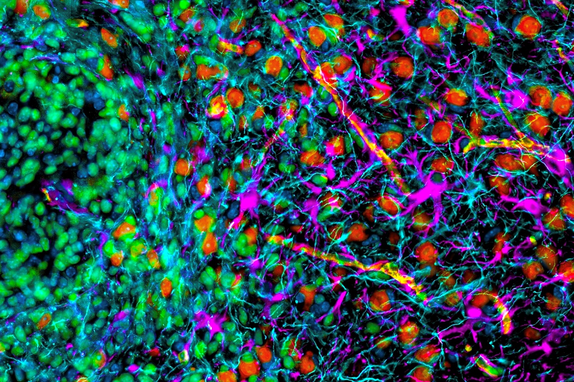 Tumor Microenvironment | Spatial Biology Workflow