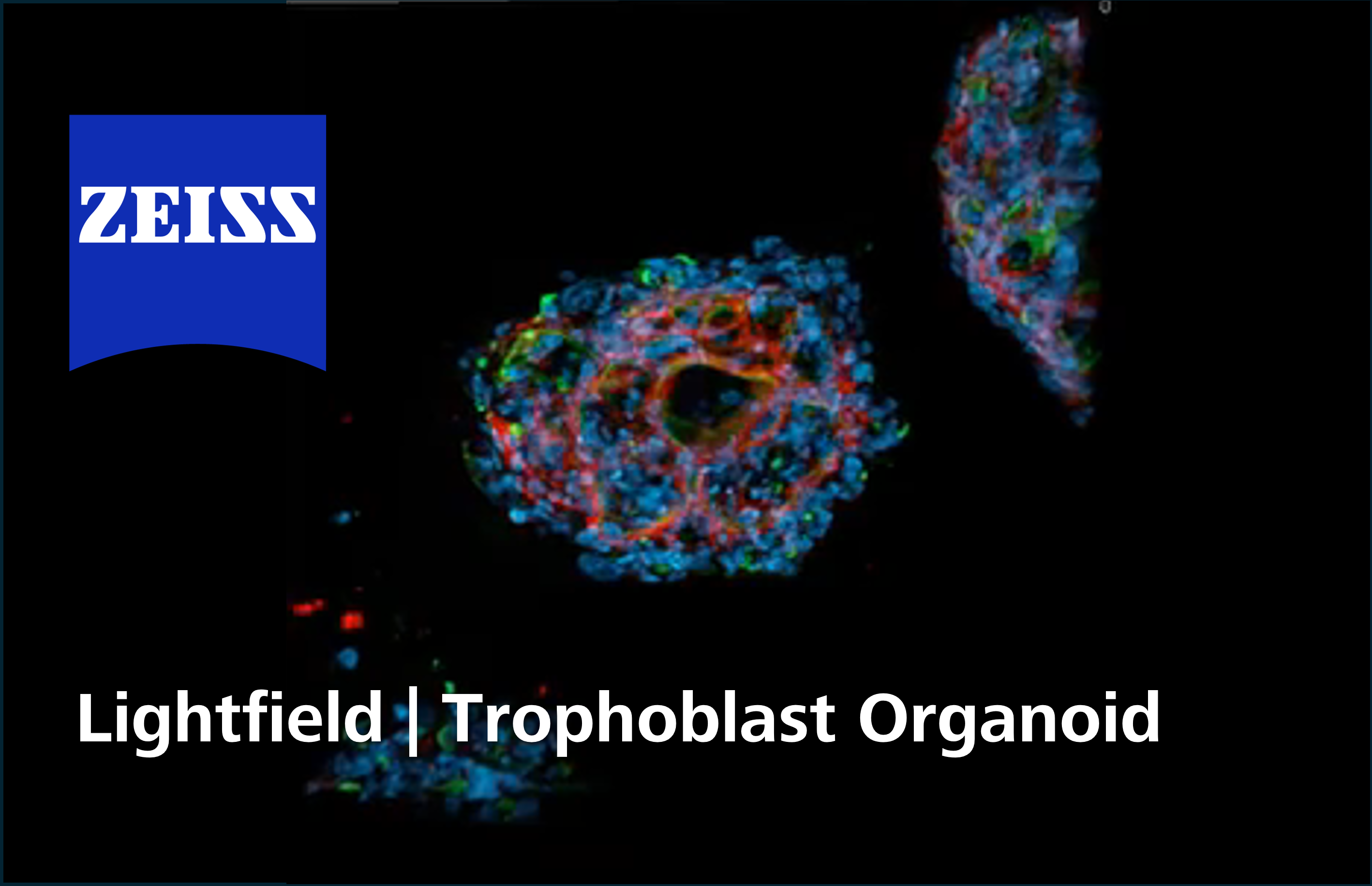 Trophoblast Organoid | LF4D