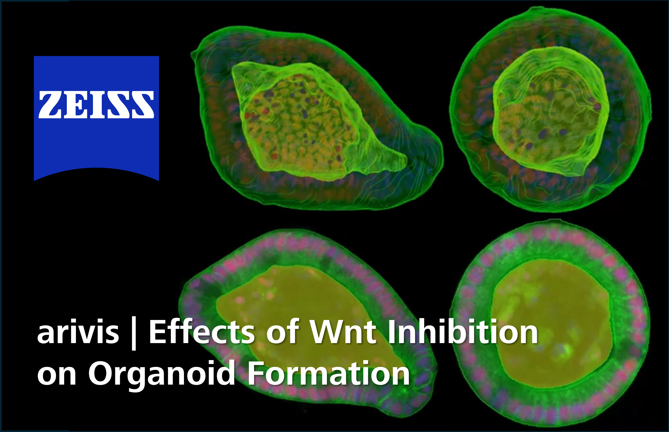 Organoid Workflow 