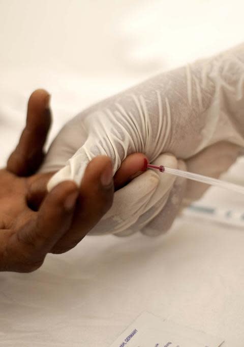 Hiv
