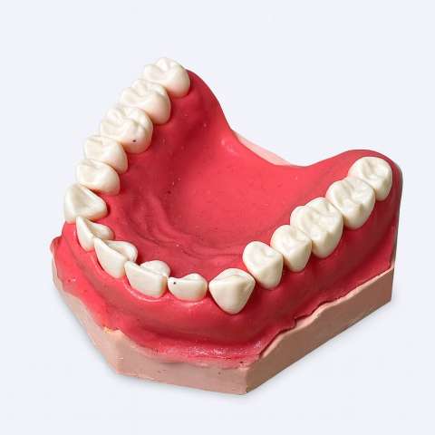 مثال لثة