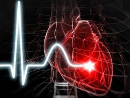 Влияние алкоголя на сердечно-сосудистую систему