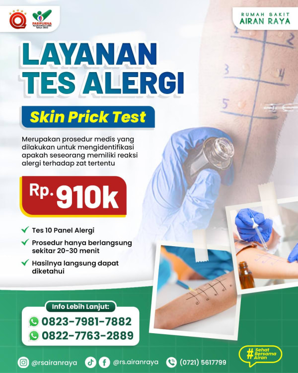 Layanan Test Alergi