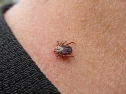 В Вологодской области зафиксирован первый в этом сезоне случай клещевого энцефалита
