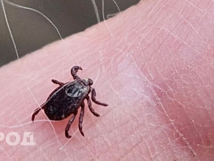 Вологодчина: клещи не дремлют - с начала сезона уже почти 8 тысяч укусов