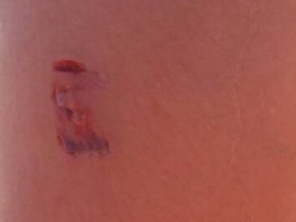 В Вологде совершено нападение на отдыхавшую на реке горожанку