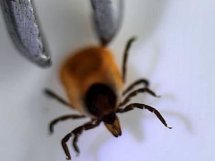 Опасное лето: более 7 000 вологжан пострадали от укусов клещей