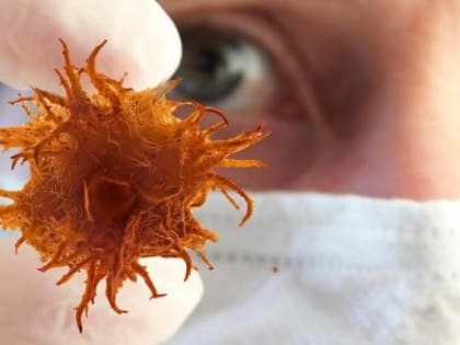 Какие люди, по мнению врачей, наиболее уязвимы перед раком