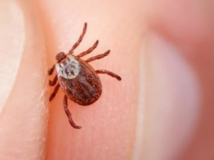Подтвержден первый в этом сезоне случай клещевого энцефалита на Вологодчине