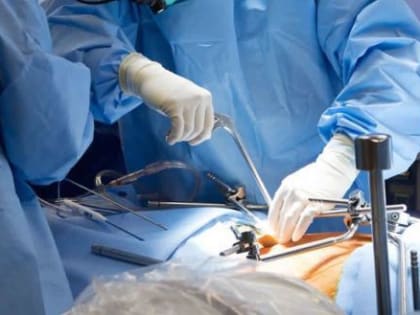 Огромную опухоль прямой кишки удалили в Вологодской областной больнице 22-летнему пациенту