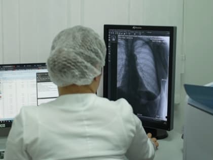 Новыми рентгеновскими комплексами оснастили медицинские организации КБР