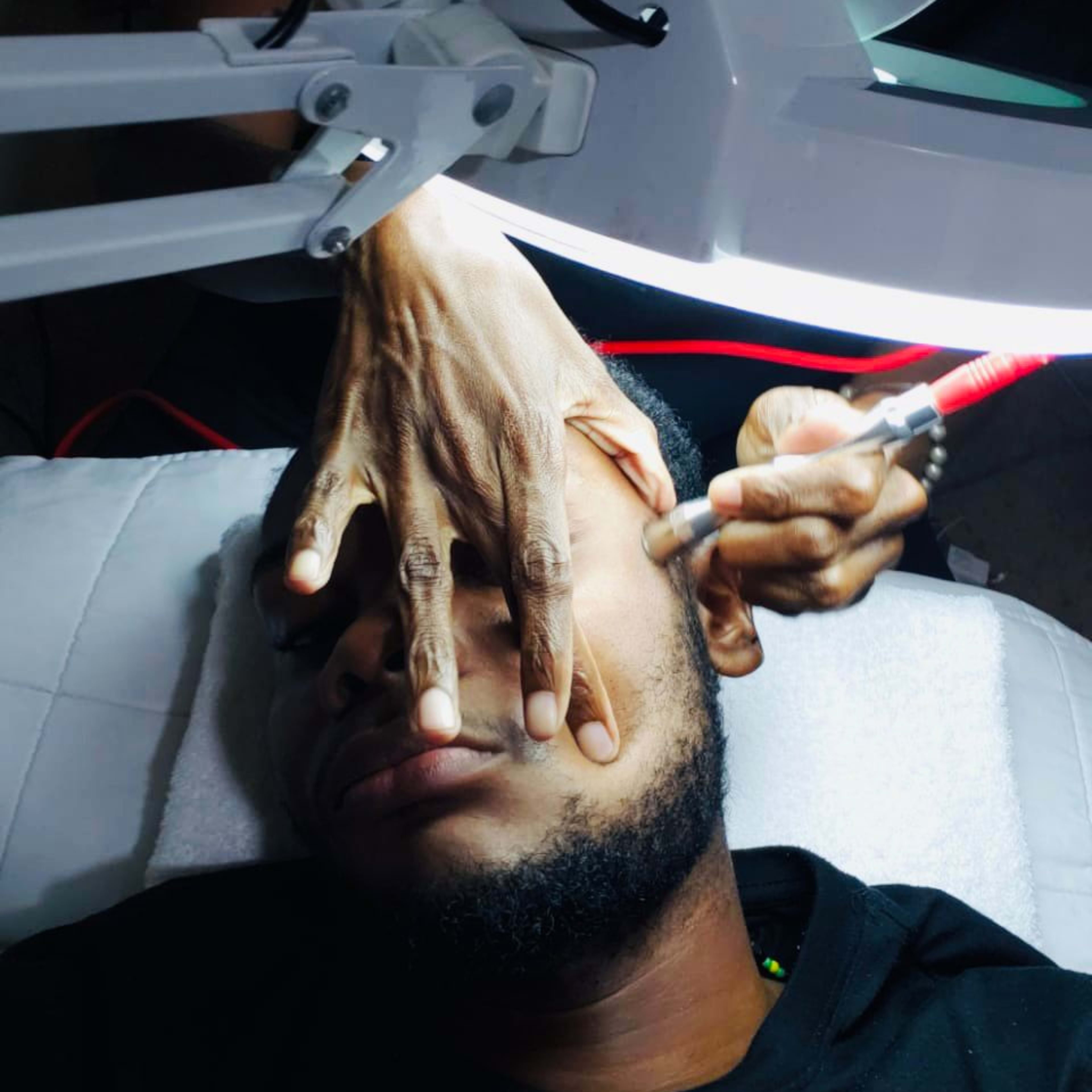 microdermabrasion.jpeg