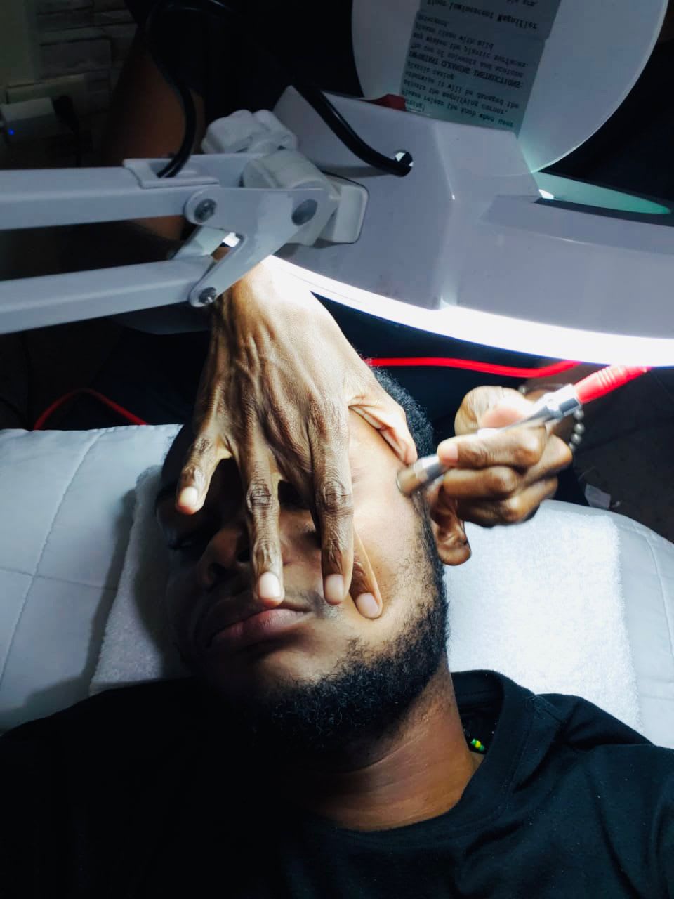 microdermabrasion.jpeg
