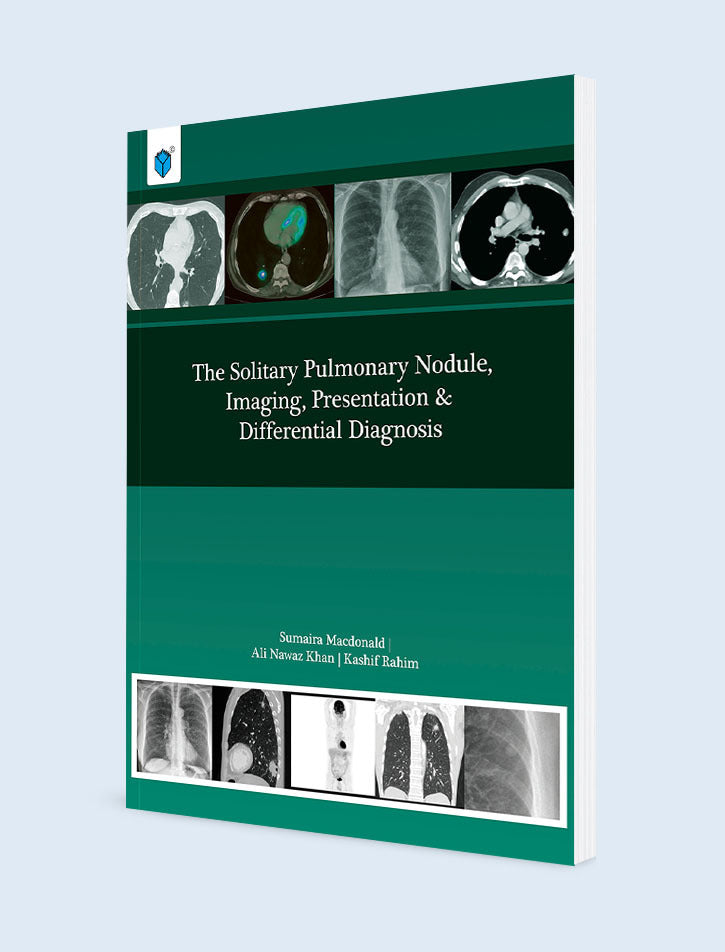 The Solitary Pulmonary Nodule, Imaging, Presentation & Differential Diagnosis