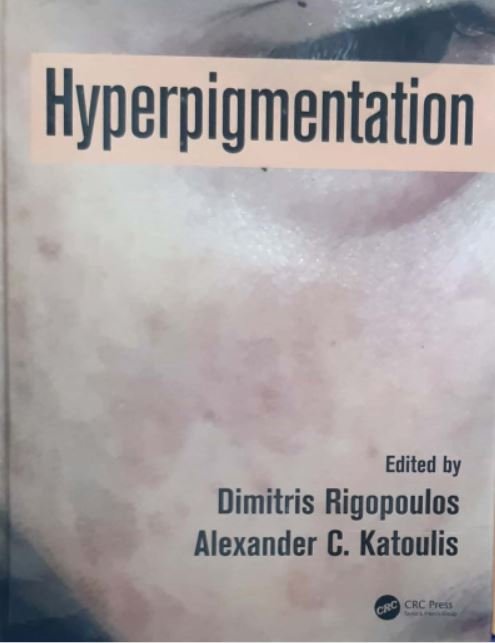 Hyperpigmentation