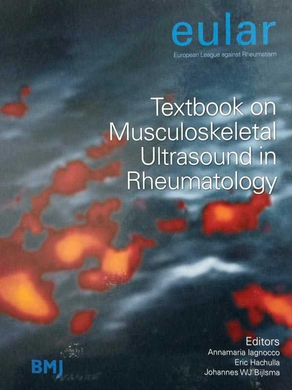 Eular Textbook on Musculoskeletal Ultrasound in Rheumatology