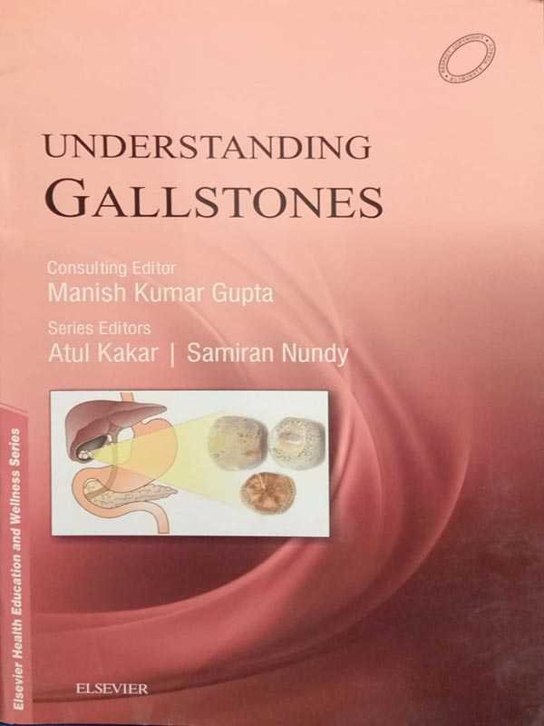 Understanding Gallstones