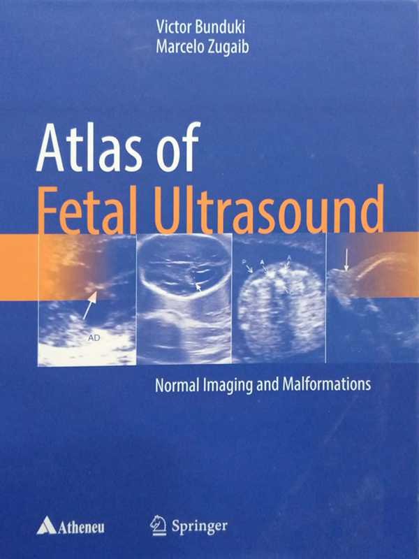 Atlas of Fetal Ultrasound
