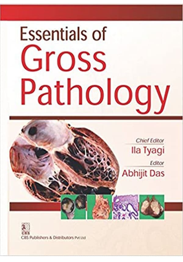 Essential of Gross Pathology 1/e Edition