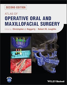 Atlas of Operative Oral and Maxillofacial Surgery 2nd Edition color book