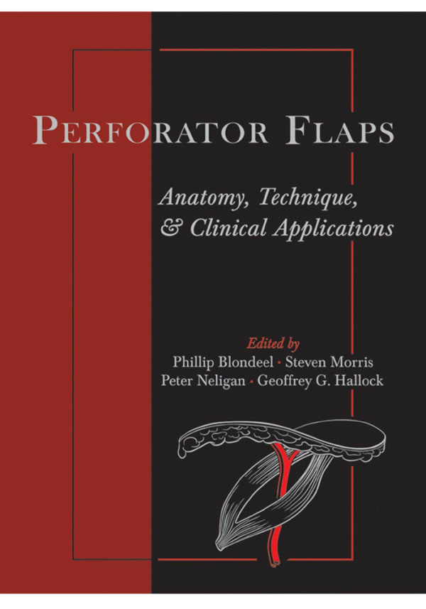 Perforator Flaps: Anatomy, Technique, & Clinical Applications 1st Edition