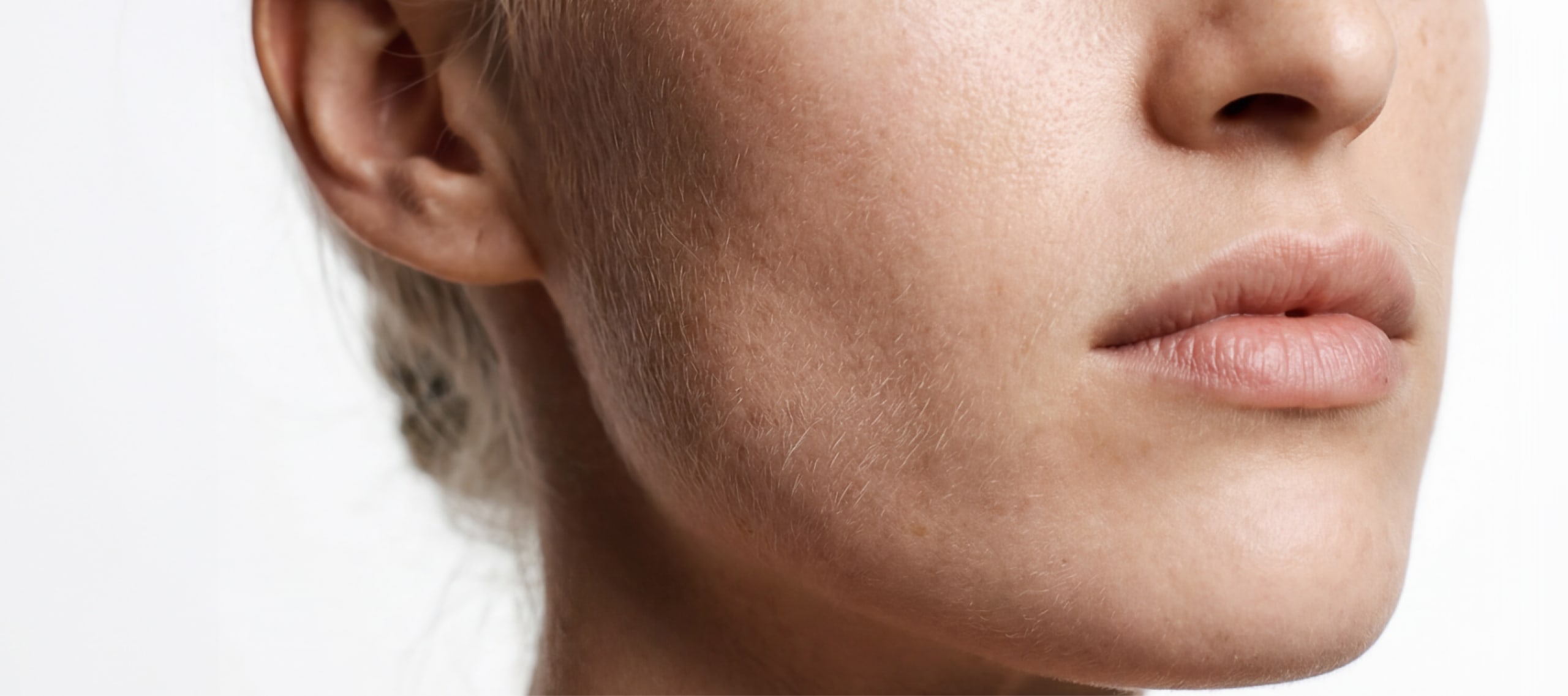 HRT vs GLP-1s for Menopausal Weight Loss: Which Is Right for You?