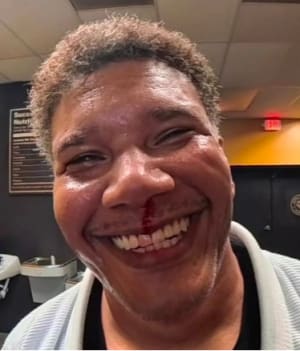 The Bloody Lip and the Beauty of Stick-To-Itiveness: How Jiu Jitsu Builds Character