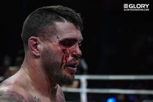 Almost time for the return of Chris Camozzi