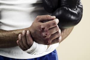 COMMON INJURIES IN MARTIAL ARTS: HANDS & ROTATOR CUFF, PART 1 OF 3