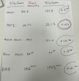 GLP-1s and Rapid Weight Loss: The Hidden Dangers of Losing Muscle Mass